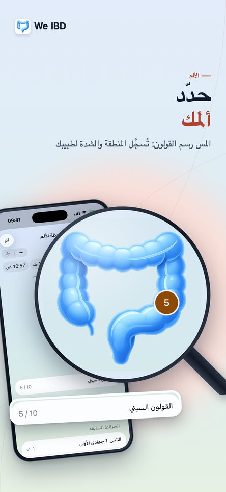 حدّد ألمك. المس رسم القولون: تُسجَّل المنطقة والشدة لطبيبك.