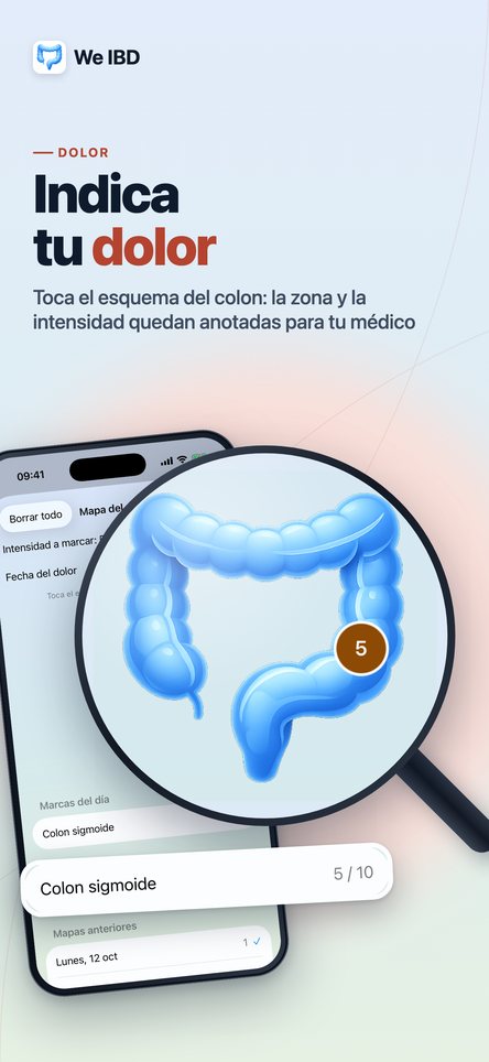 Indique su dolor. Toque el esquema del colon: la zona y la intensidad quedan anotadas para su médico.